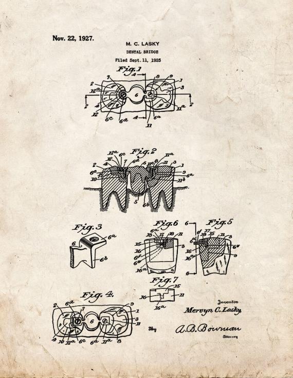 Dental Bridge Patent Print