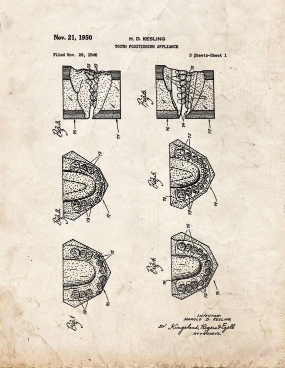 Tooth Positioning Appliance Patent Print