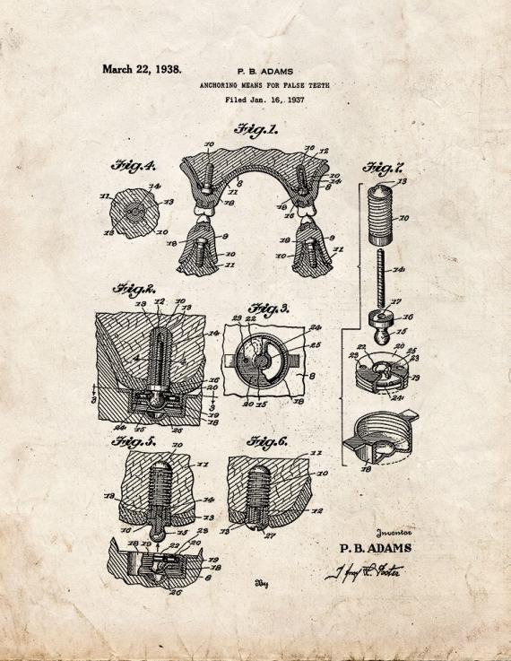 Anchoring Means for False Teeth Patent Print