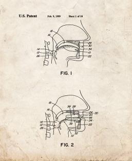 Dental Appliance for Treatment Of Snoring and Obst...