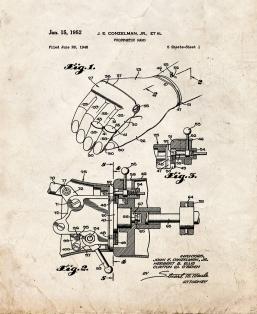Prosthetic Hand