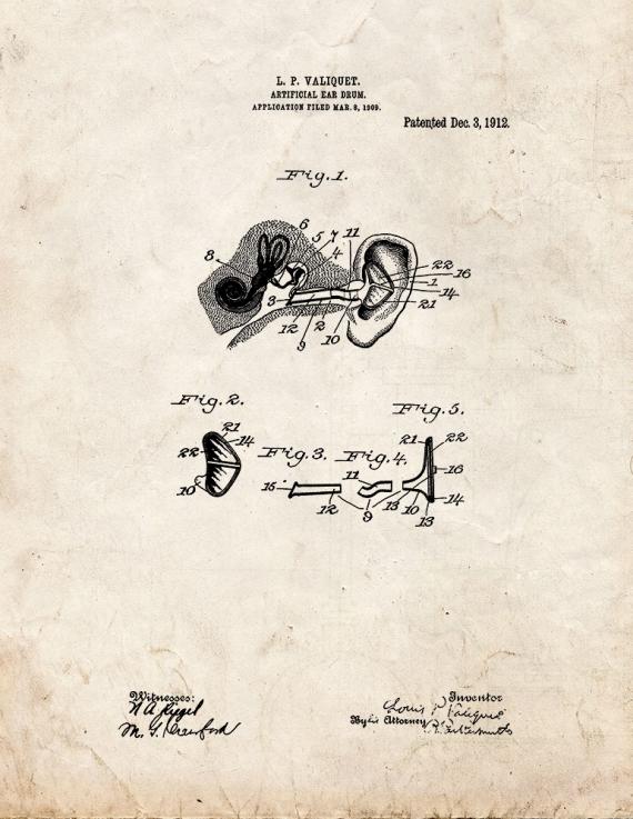 Artificial Ear-drum Patent Print